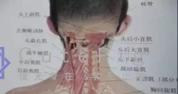 后脑勺的机关——头痛头晕治疗点插图7